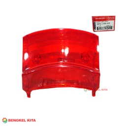 [93393] AHM MIKA STOP SUPRA-FIT